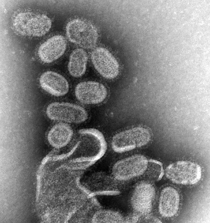 Influenza virus micrograph